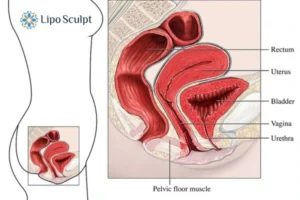 Treatment For A Leaky Bladder 2 How EM Chair treatment Solihull can help Leaky bladder issues. Read more now!